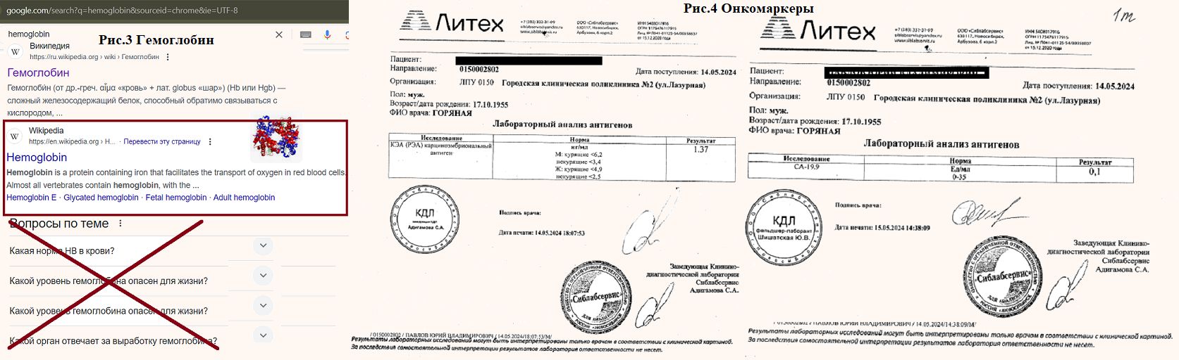 «Изображение к посту “Рис.3 и рис.4 к книге Как я рак победил”»