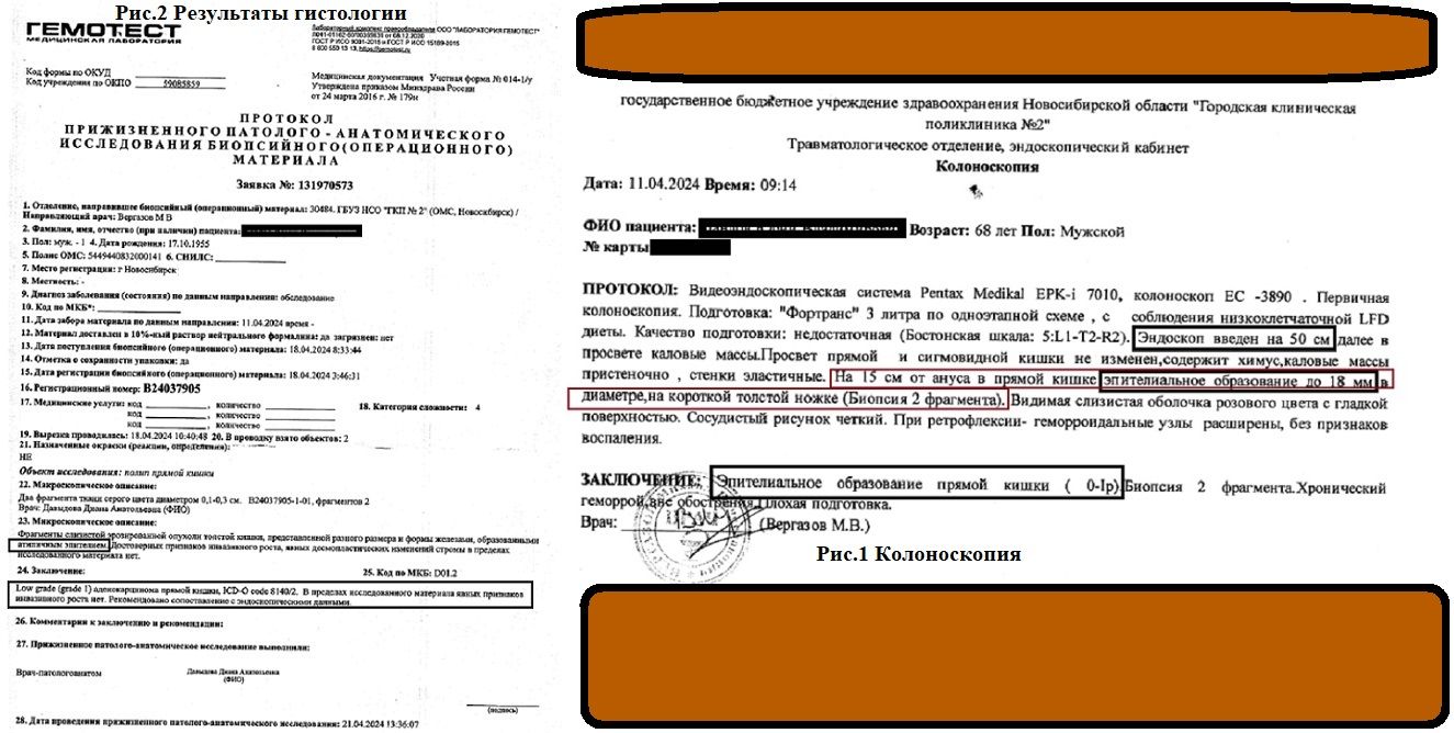 «Изображение к посту “Рис.1 и рис.2 к книге "Как я рак победил"”»